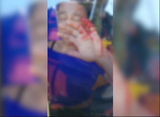 Capa Mulher é brutalmente agredida por cinco homens em o Fundo; caso está sob investigação